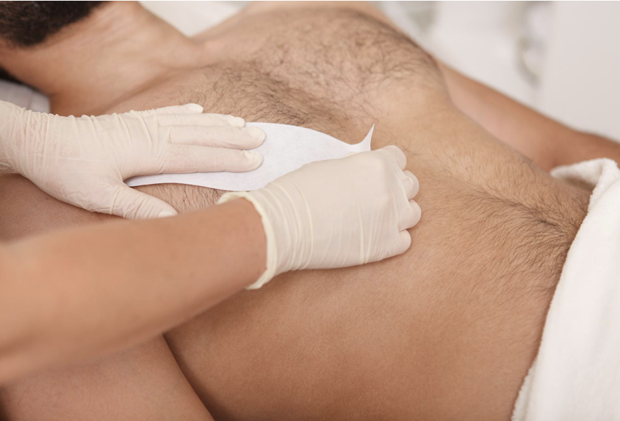 EPILATION HOMME : ÉPAULES image